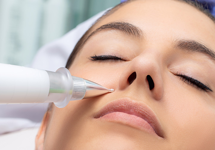 Jato-de-plasma-facial